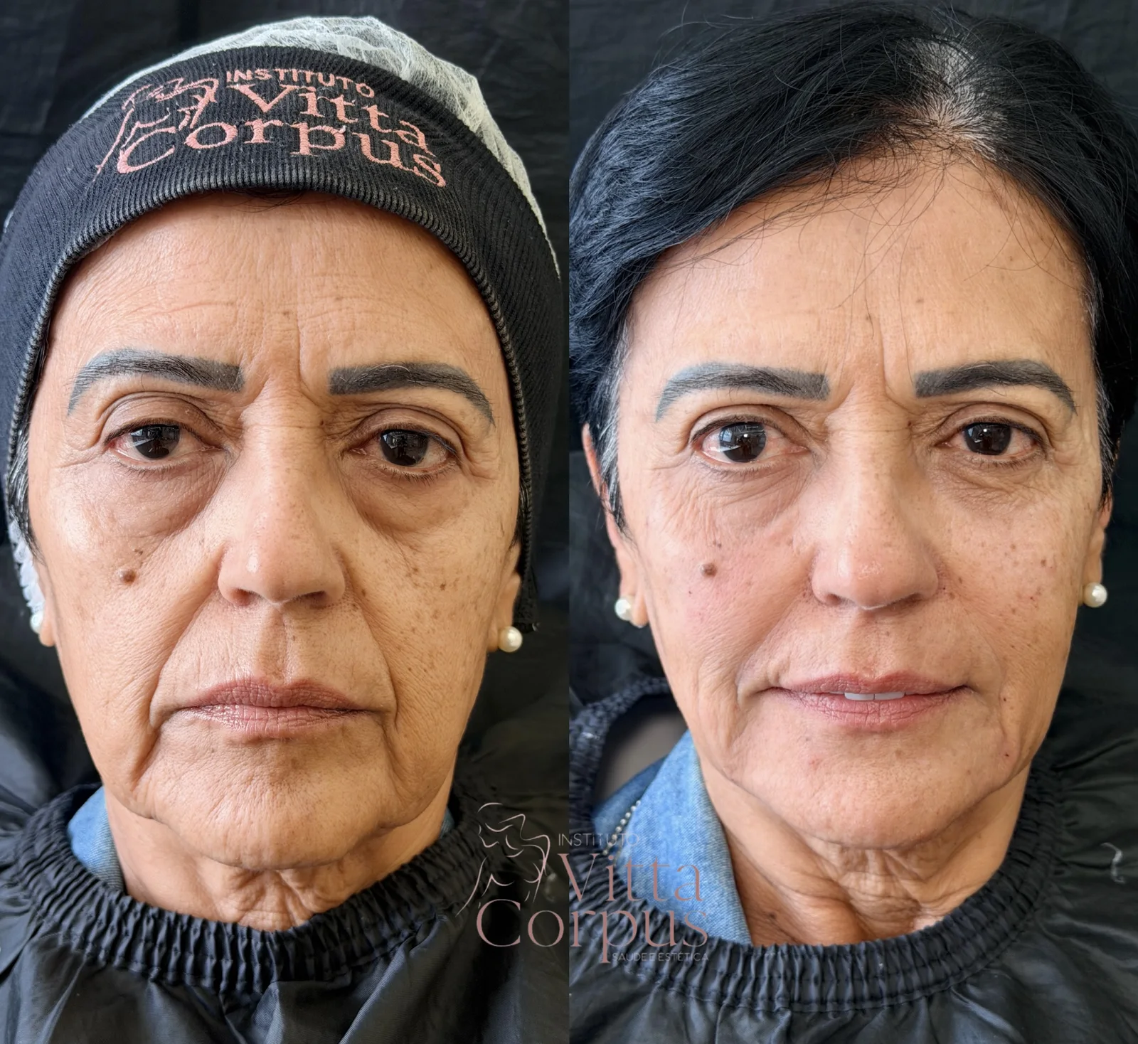 Comparativo de antes e depois do case 4